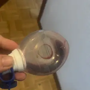 Secreción por abdominoplastía