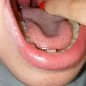 Otaku vore rojo