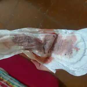 Pack dos compresas con sangre