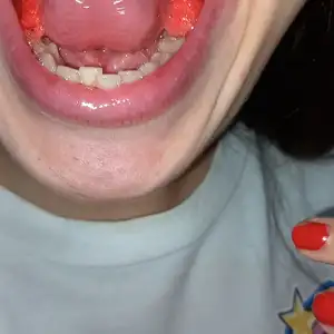 Otaku vore rojo