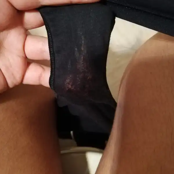 Bragas con flujo vaginal