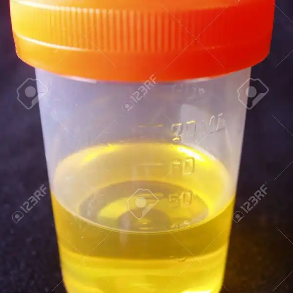 Botecito de mi rico pis